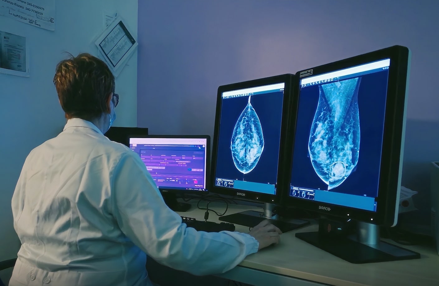 Interpret 3D Mammograms with Speed and Precision