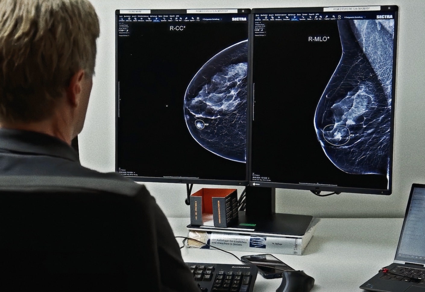 Detect Breast Cancer with Greater Clarity and Confidence