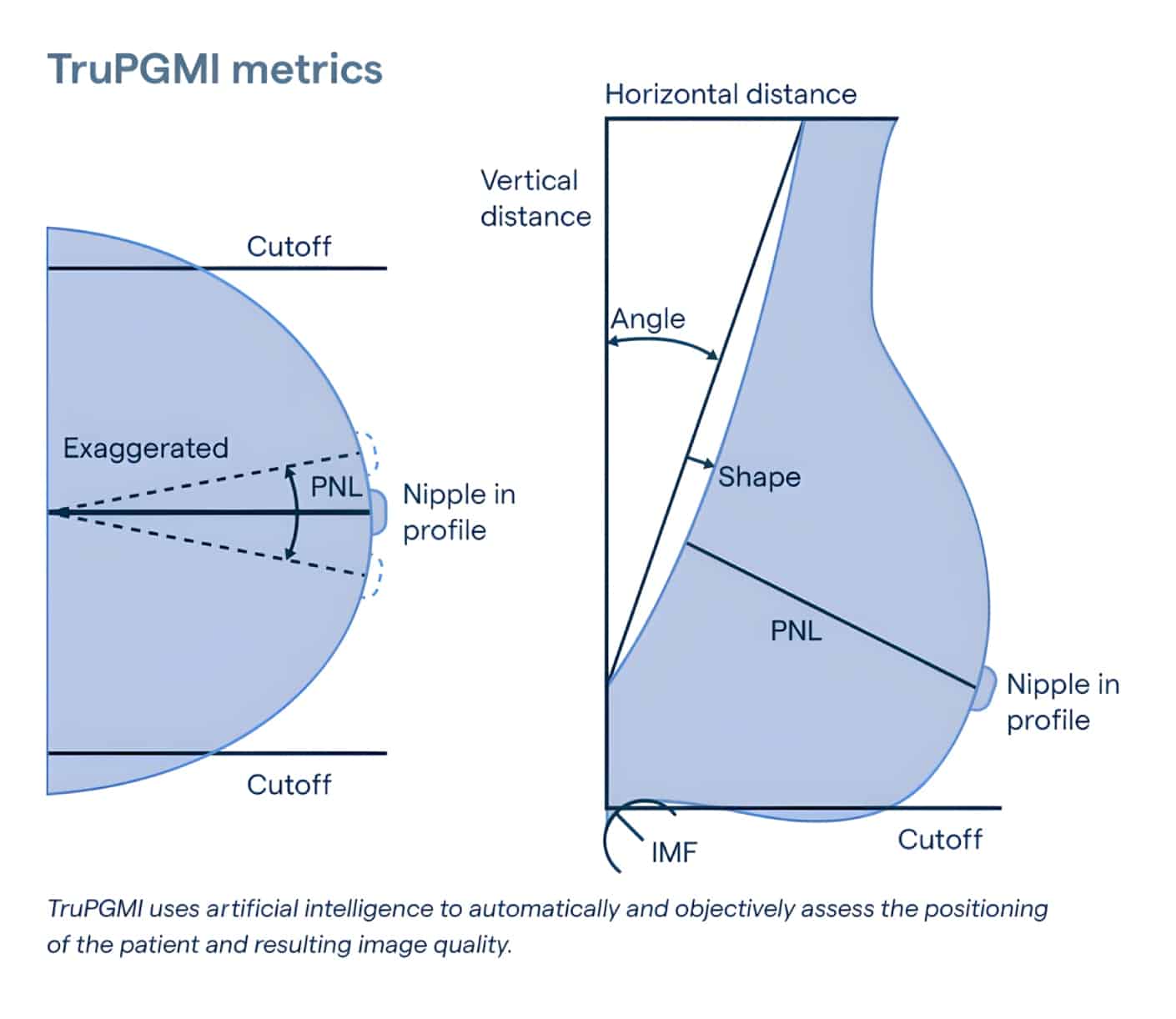 Automated image quality assessment