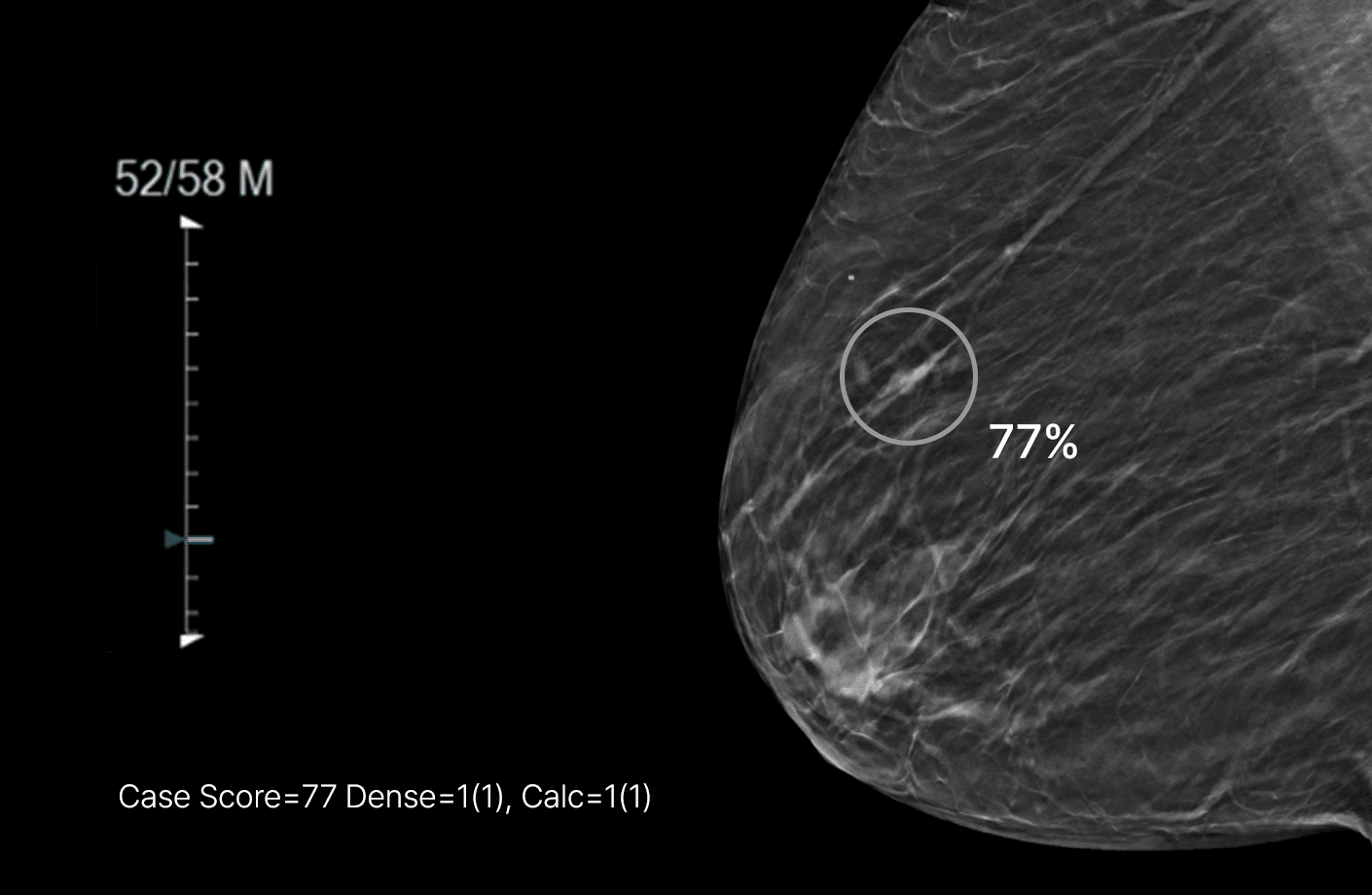 원본 영상 위 분석결과 표시