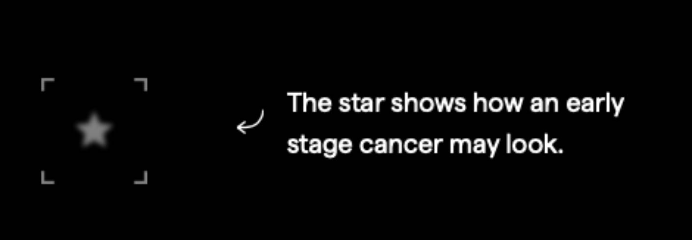 Breast density and risk — why it’s important