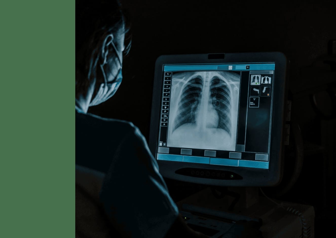 High-Volume Chest X-ray Interpretation, Optimized by AI