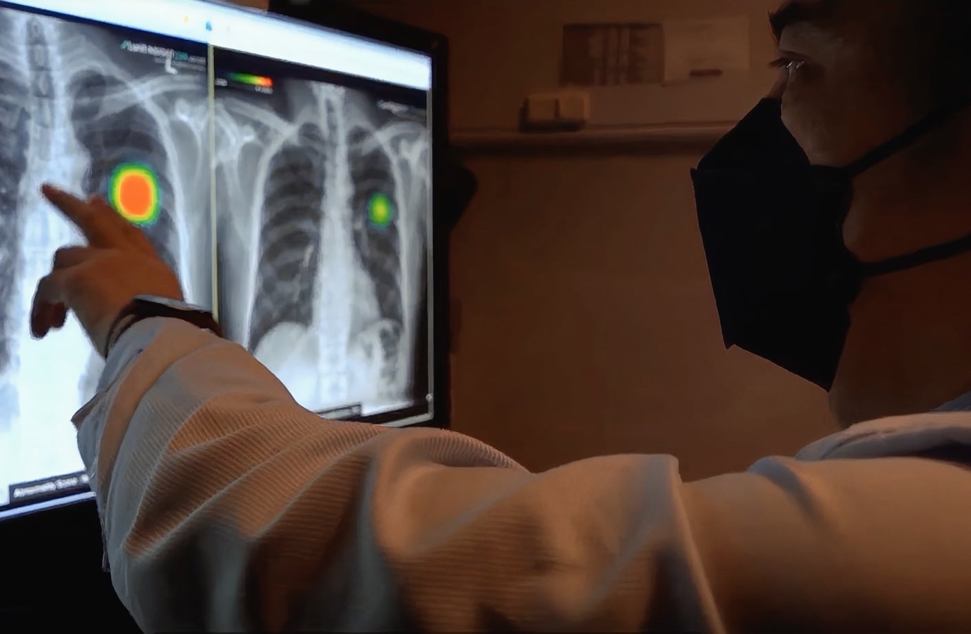 Clinician using AI radiology software to assess diagnostic imaging on dual monitors.