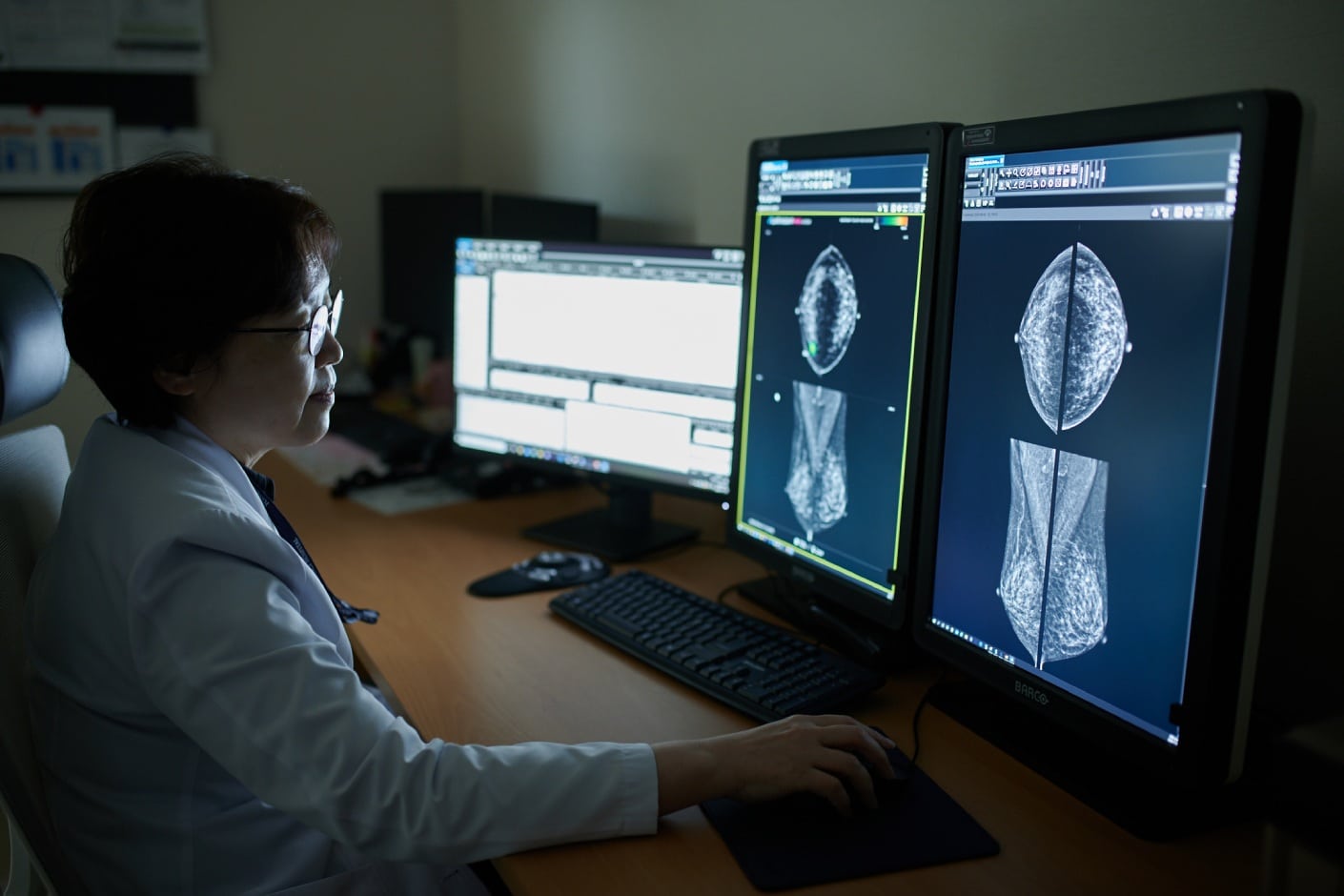 "Doctor evaluating breast imaging results using AI-powered radiology software."