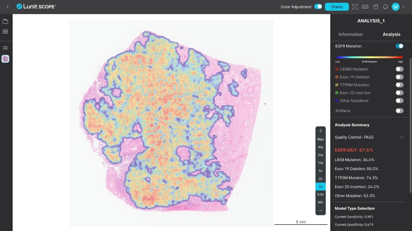 Case Study: Co-developmentwith AstraZeneca 