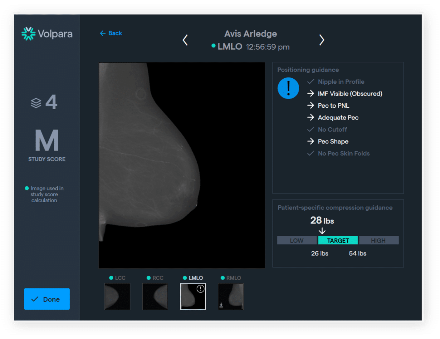 Screenshot of mammography software interface showing real-time image quality feedback on positioning and compression for continuous technologist skill improvement.