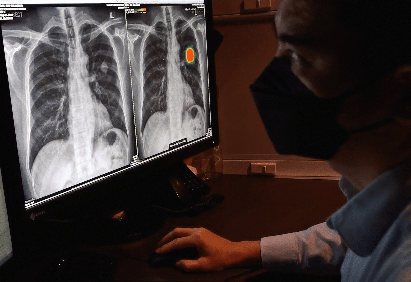 Transform Your Chest Imaging Workflow with AI