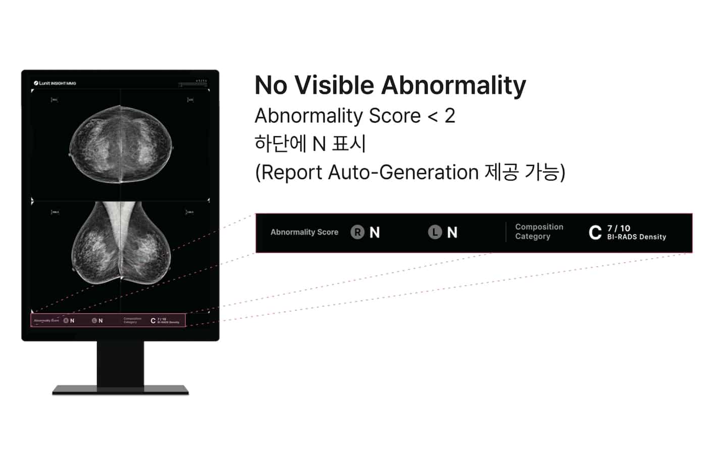 정상 케이스 표시